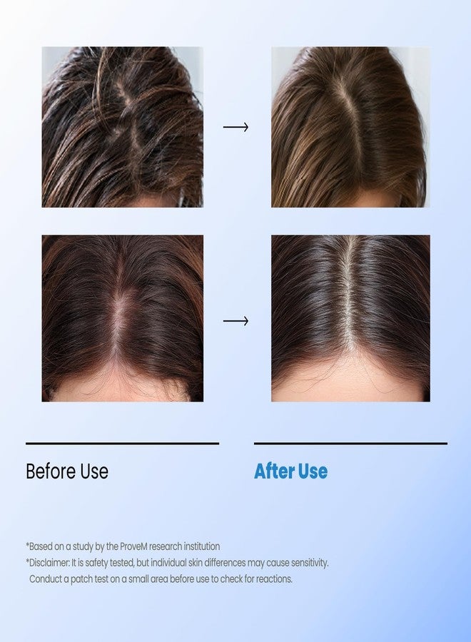 سيبوري تونيك سيبوري الفقاعي | رغوة مقشرة لفروة الرأس تُترك على الشعر، مناسبة للشعر الدهني أو المتعرق أو الذي يُسبب الحكة | يزيل التراكمات والعرق دون ترك أي بقايا | شعور بالانتعاش بفضل المنثول وحمض الساليسيليك | مُنظف للشعر على الطريقة الكورية - Image 5